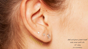 سوراخ کردن گوش | پیرسینگ گوش (ear piercing)