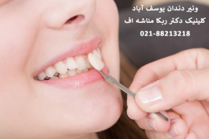 معرفی دندان پزشک | دکتر ایمپلنت دندان