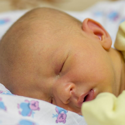 درمان سریع زردی نوزاد