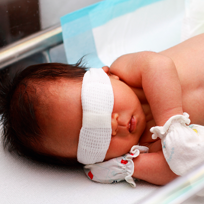 درمان سریع زردی نوزاد