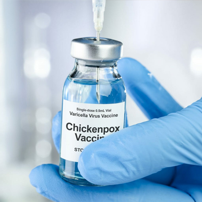 اقدامات قبل و بعد از واکسن آبله مرغان