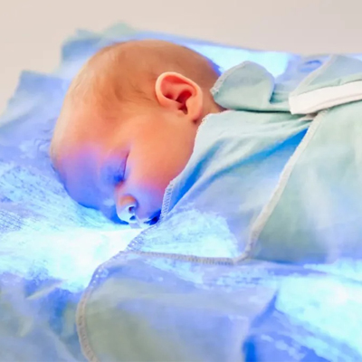 تفاوت زردی فیزیولوژیک و پاتولوژیک در نوزادان