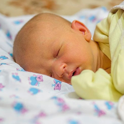 تفاوت زردی فیزیولوژیک و پاتولوژیک در نوزادان